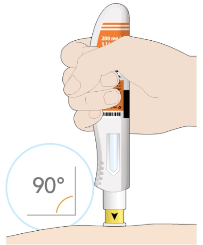 needle cover on skin at 90-degree angle